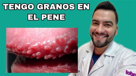 granos en la punta del pene|Granos en el pene: 10 tipos ofensivos e inofensivos